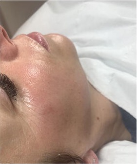 A client lying on the treatment bed